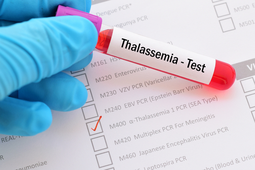 Call For Support For Children Suffering From Thalassemia
